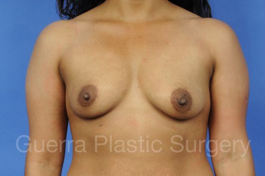 prev Case #1001023 Before