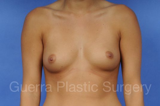 prev Case #1001025 Before