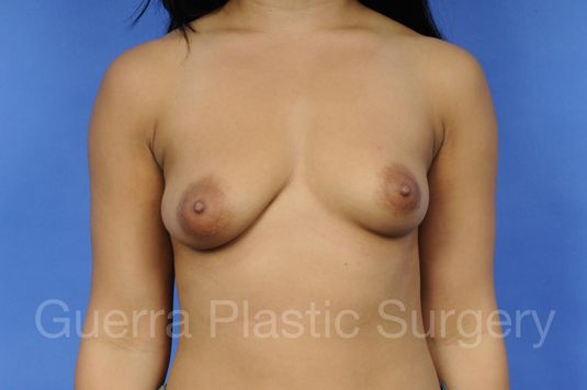 prev Case #1001035 Before