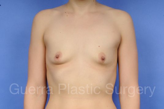 prev Case #1001043 Before