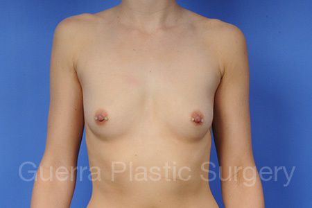 prev Case #1001056 Before