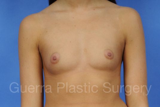 prev Case #1001062 Before