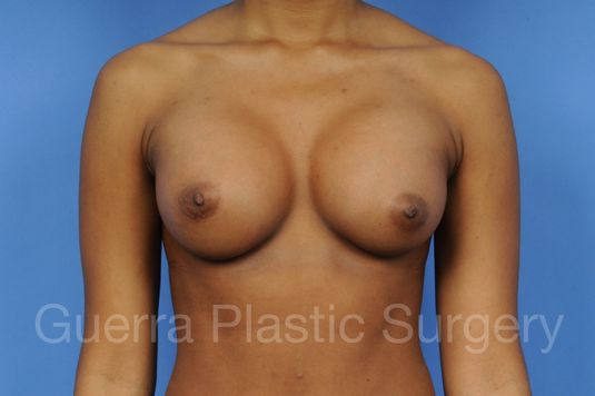 next Case #1001079 After