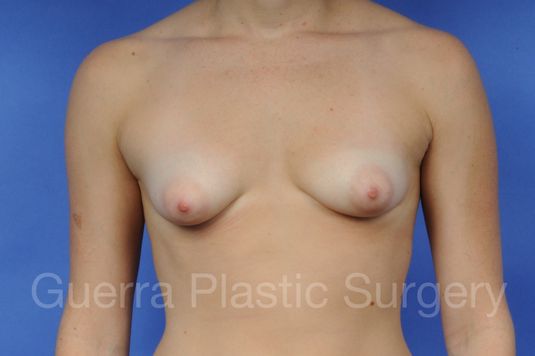 prev Case #1003002 Before