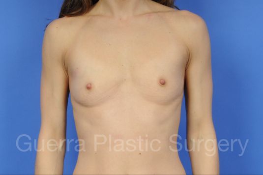 next Case #15136 Before