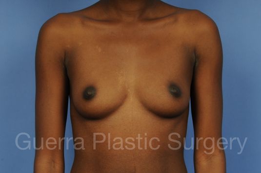 prev Case #1002021 Before