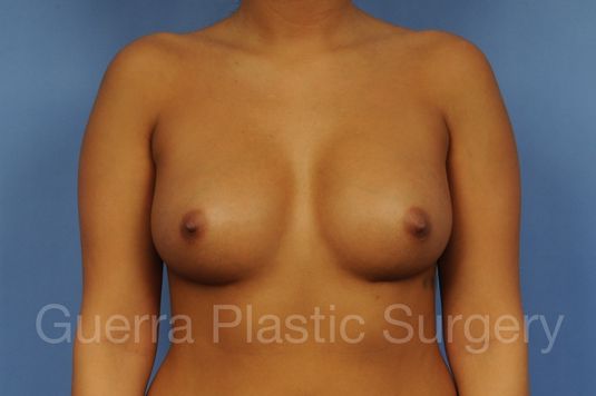 next Case #1002023 After