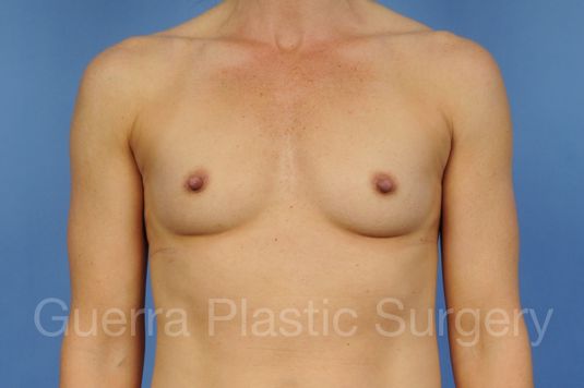 prev Case #1002012 Before