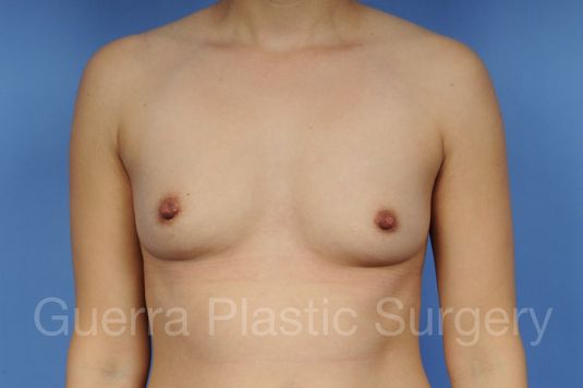 prev Case #100201104 Before