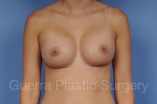 next Case #1002030 After