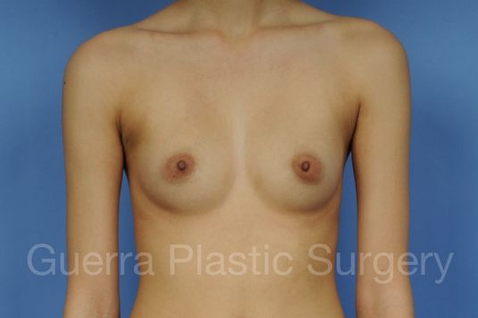 prev Case #1002024 Before