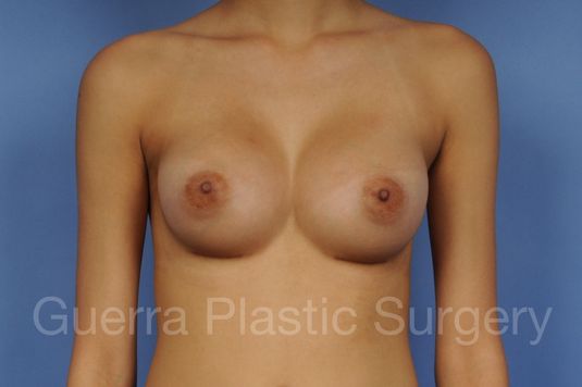 prev Case #1002024 After