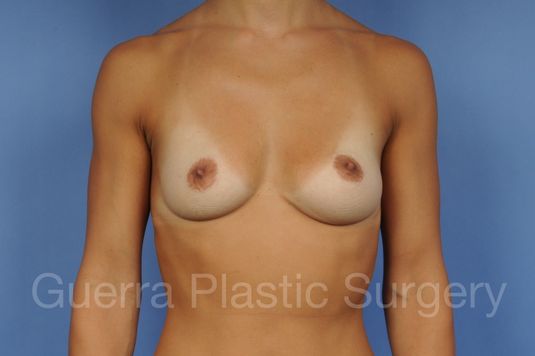 prev Case #1002047 Before