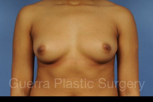 prev Case #1001097 Before