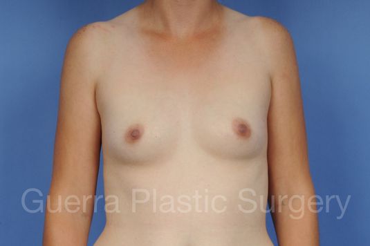 prev Case #1001100 Before