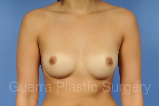 prev Case #1001114 Before