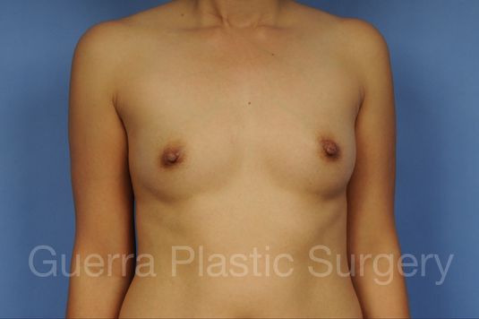 prev Case #1001117 Before