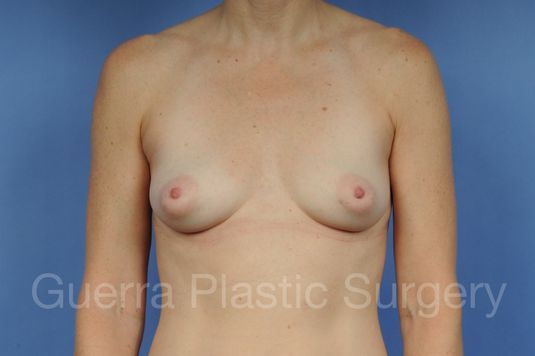 prev Case #1001122 Before