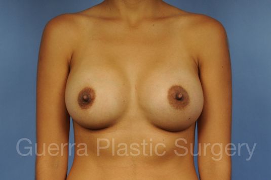 next Case #1001133 After