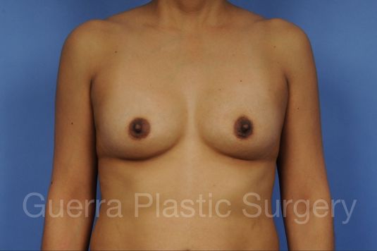 prev Case #1001135 Before