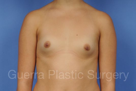 prev Case #1001136 Before