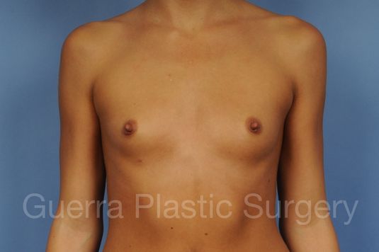 prev Case #1001138 Before