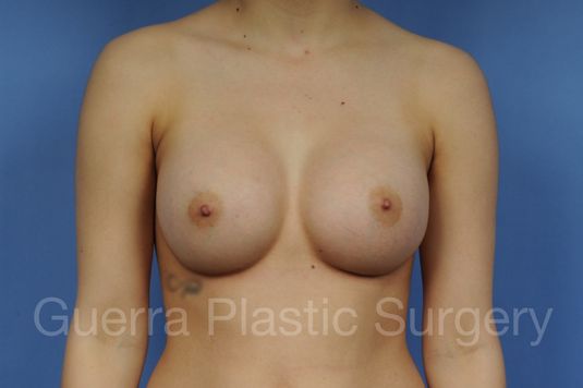 next Case #1001139 After