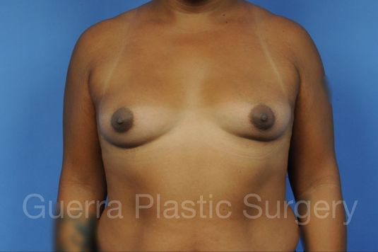 prev Case #1001142 Before