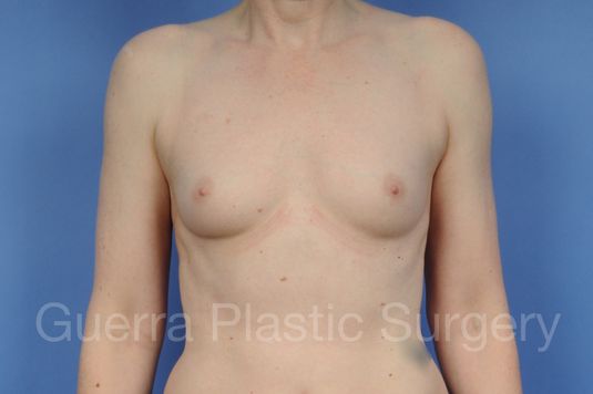 prev Case #1002042 Before