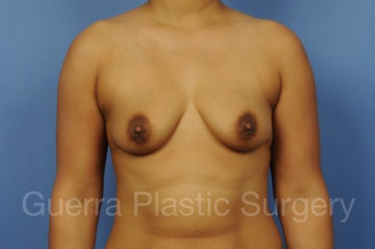 prev Case #1002045 Before