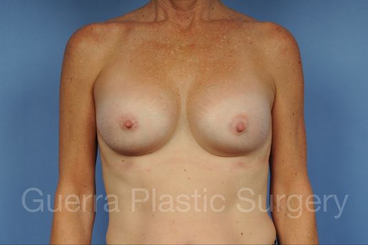 next Case #1002048 After