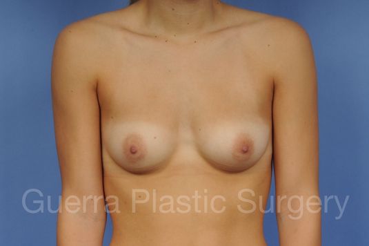 prev Case #1001147 Before