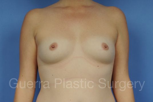 prev Case #1001153 Before