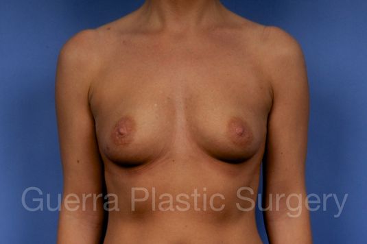 prev Case #1001162 Before