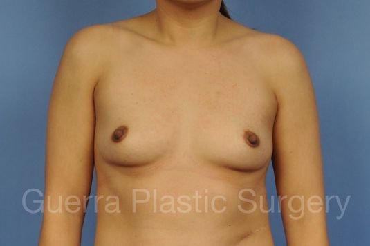 prev Case #1001164 Before