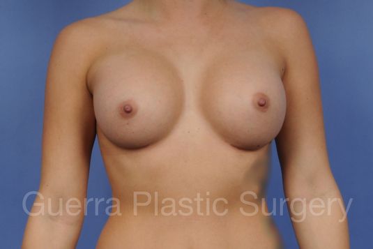 next Case #1001165 After