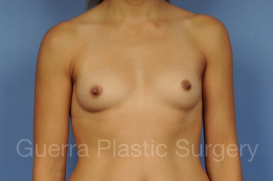 prev Case #1001166 Before