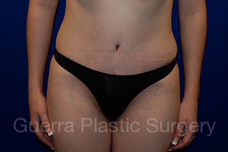 next Case #144889 After