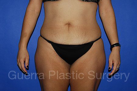 next Case #34829 Before