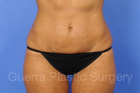 prev Case #30222 Before