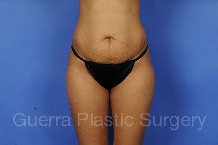 prev Case #85641 Before