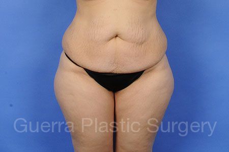 prev Case #97996 Before