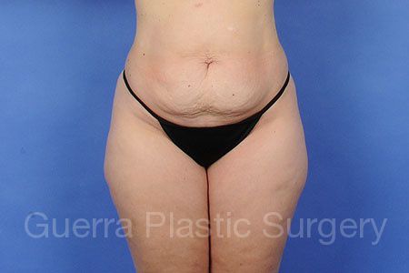 prev Case #56899 Before