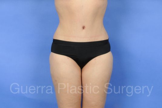 next Case #01228 After