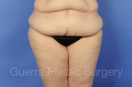 prev Case #01236 Before