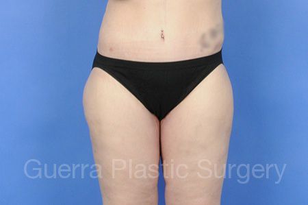 prev Case #01236 After