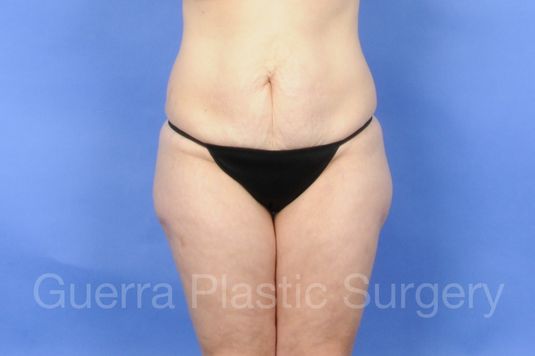 prev Case #01253 Before