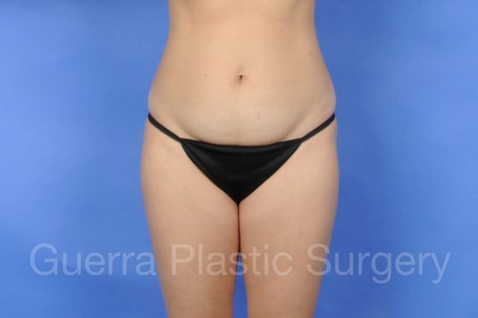 next Case #01261 Before