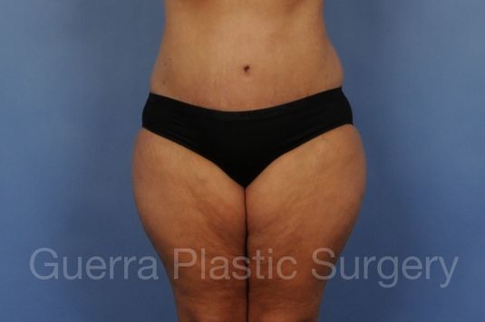 prev Case #01269 After