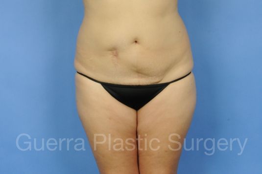 prev Case #01279 Before